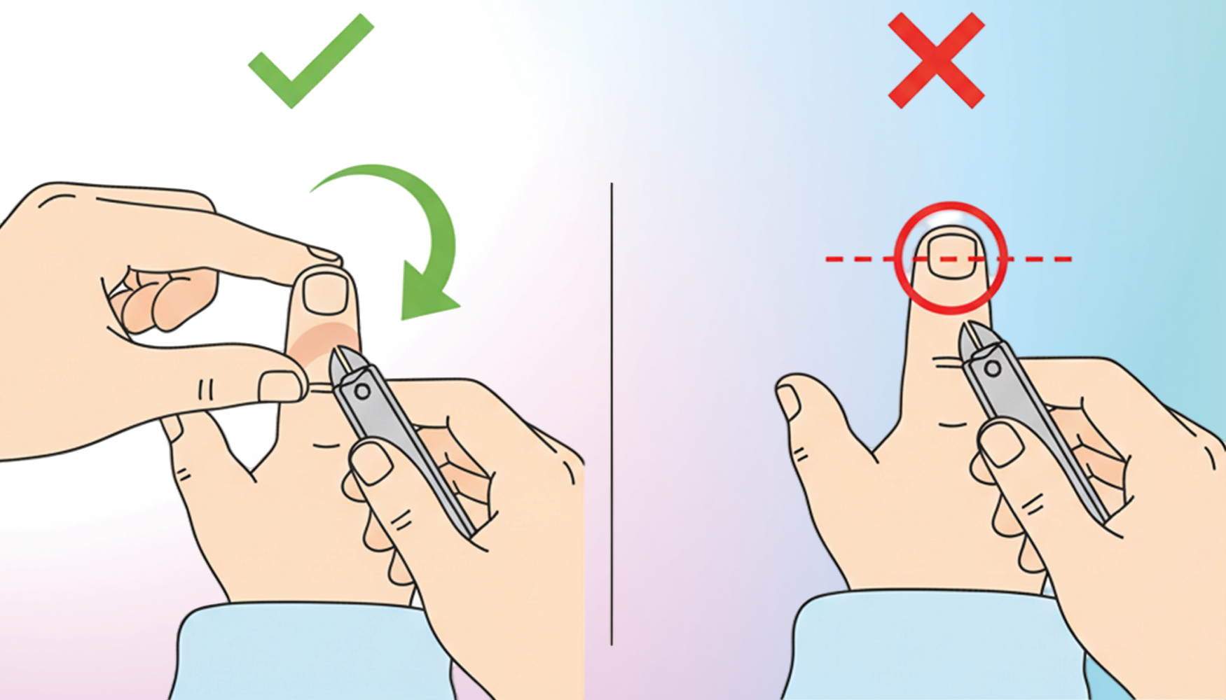 Baby Scratching Face? The Ultimate Newborn Nail Care Guide